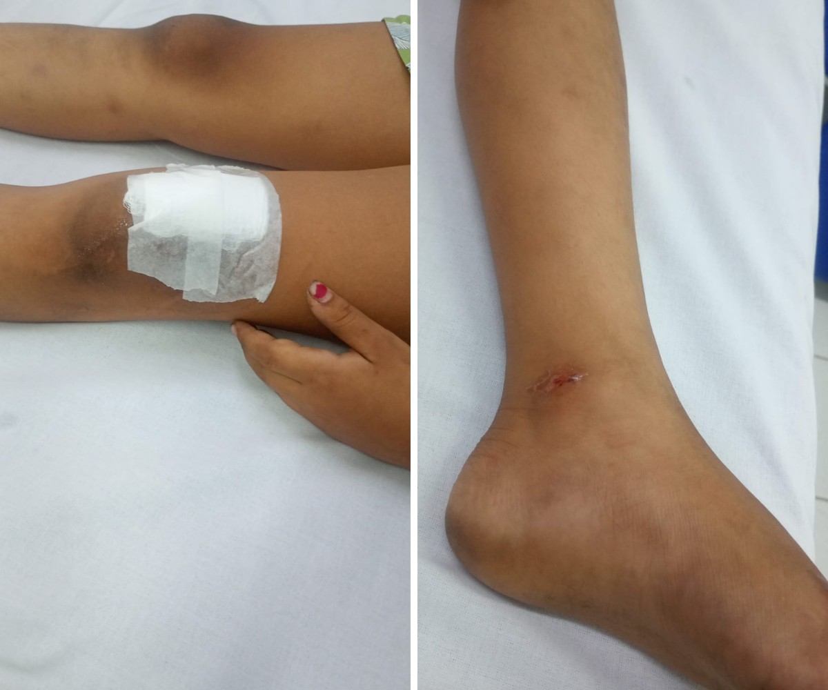 foto Not&iacute;cia São Pedro